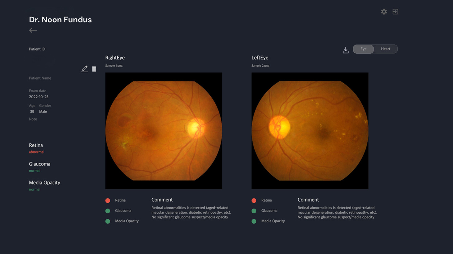 Dr. Noon Fundus — ukážka výstupu